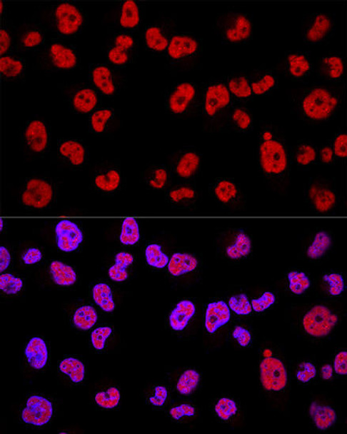 Cell Biology Antibodies 12 Anti-METTL3 Antibody CAB8370