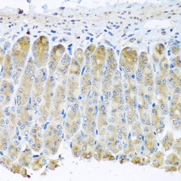 Metabolism Antibodies 3 Anti-TAMM41 Antibody CAB8374