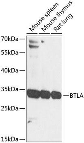 Immunology Antibodies 3 Anti-BTLA Antibody CAB8377