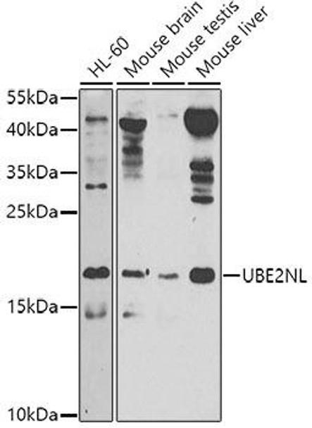 Cell Biology Antibodies 12 Anti-UBE2NL Antibody CAB8381