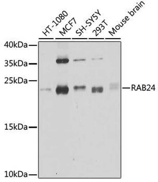 Autophagy Antibodies Anti-RAB24 Antibody CAB8394