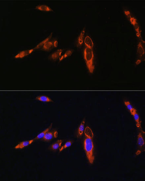 Cell Biology Antibodies 12 Anti-AVPR1A Antibody CAB8400