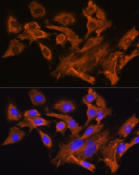 Cell Biology Antibodies 12 Anti-AVPR1A Antibody CAB8400