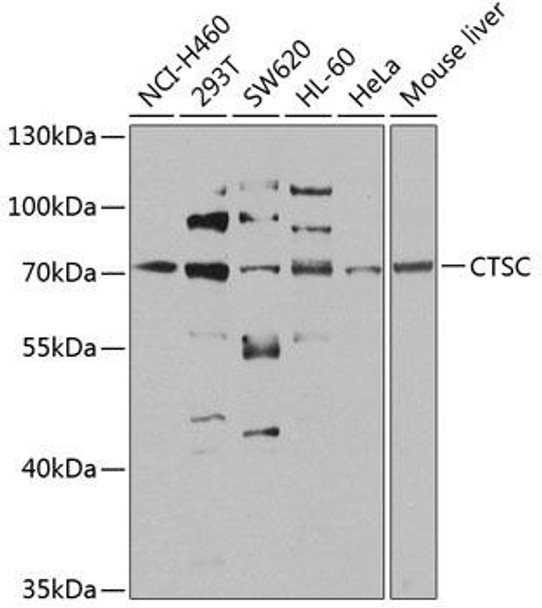 Cell Biology Antibodies 12 Anti-CTSC Antibody CAB8403