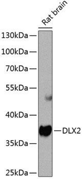 Developmental Biology Anti-DLX2 Antibody CAB8410