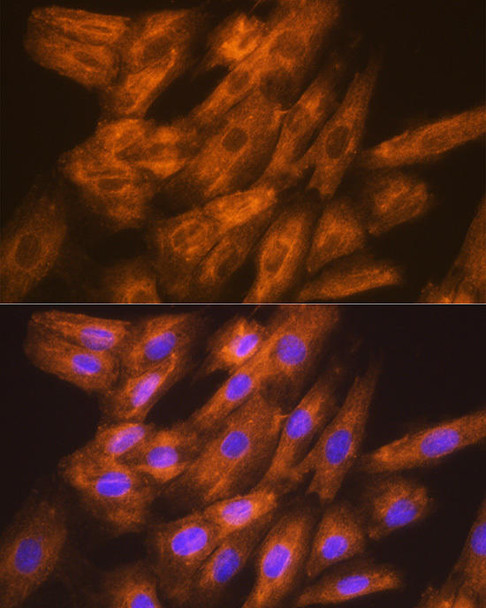 Signal Transduction Antibodies 3 Anti-DSPP Antibody CAB8413