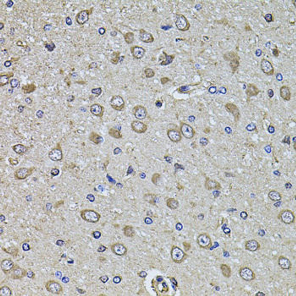 Cell Biology Antibodies 12 Anti-EPHA3 Antibody CAB8414