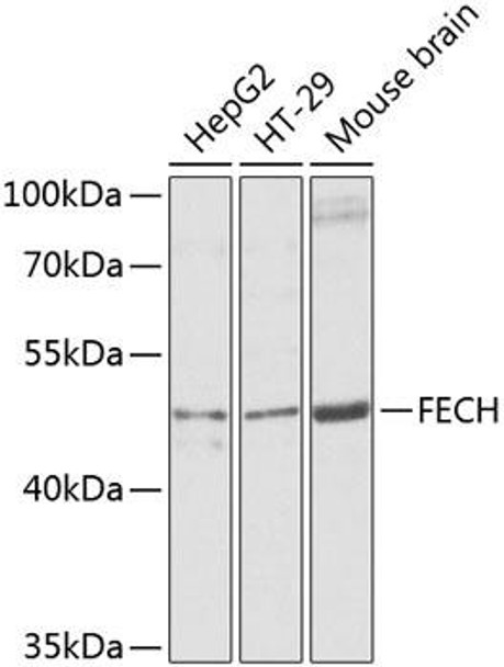 Metabolism Antibodies 3 Anti-FECH Antibody CAB8418