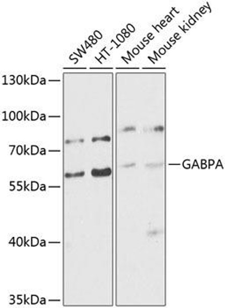 Epigenetics and Nuclear Signaling Antibodies 4 Anti-GABPA Antibody CAB8419