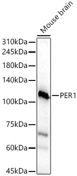 Western blot analysis of lysates from Mouse brain, using PER1 Rabbit Polyclonal Antibody (CAB8449) at 1:1000 dilution. Secondary antibody: HRP-conjugated Goat anti-Rabbit IgG (H+L) at 1:10000 dilution. Lysates/proteins: 25 µg per lane. Blocking buffer: 3% nonfat dry milk in TBST. Detection: ECL Basic Kit. Exposure time: 60 s.