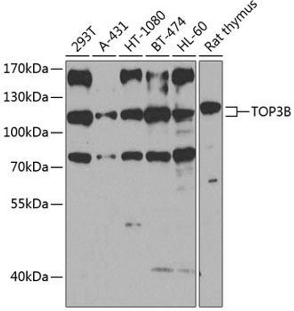 Cell Biology Antibodies 12 Anti-TOP3B Antibody CAB8469