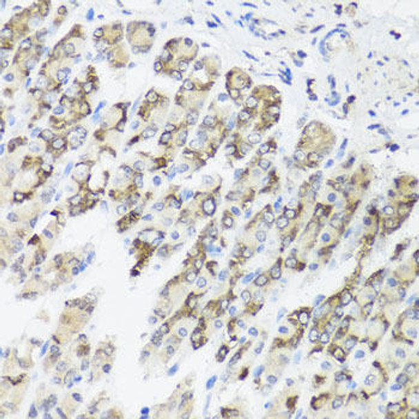 Cell Biology Antibodies 12 Anti-TIMM10B Antibody CAB8488