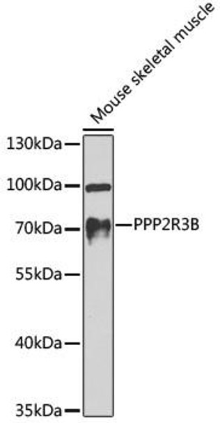 Cell Biology Antibodies 12 Anti-PPP2R3B Antibody CAB8489