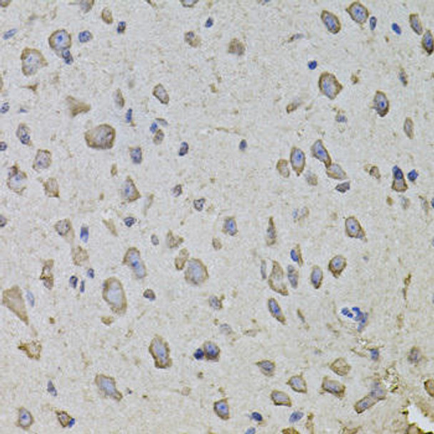 Cell Biology Antibodies 12 Anti-ARHGEF3 Antibody CAB8490