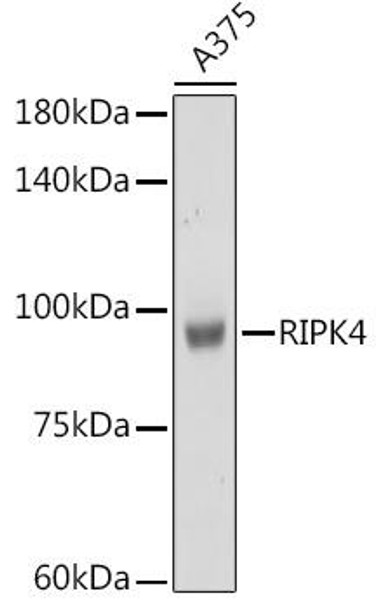 Cell Biology Antibodies 12 Anti-RIPK4 Antibody CAB8495