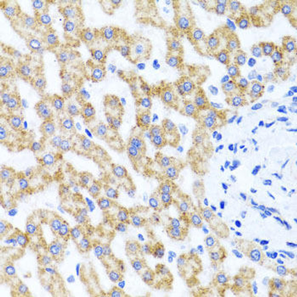 Cell Biology Antibodies 12 Anti-RIPK4 Antibody CAB8495