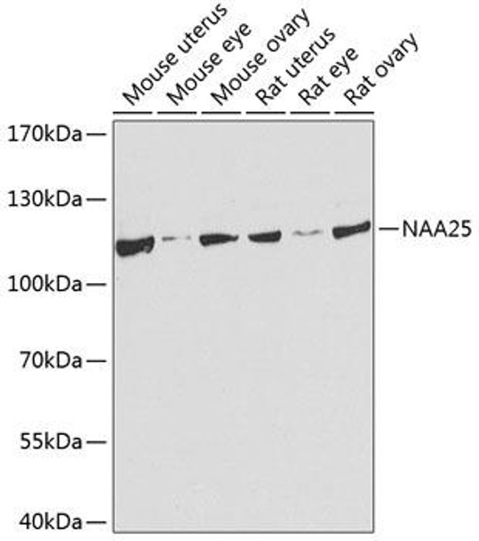 Cell Biology Antibodies 12 Anti-NAA25 Antibody CAB8516