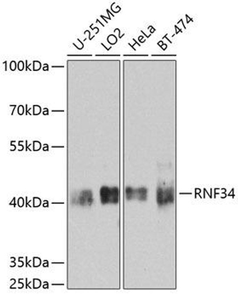 Cell Death Antibodies 2 Anti-RNF34 Antibody CAB8517