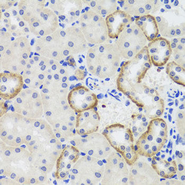 Epigenetics and Nuclear Signaling Antibodies 4 Anti-MTERFD3 Antibody CAB8518