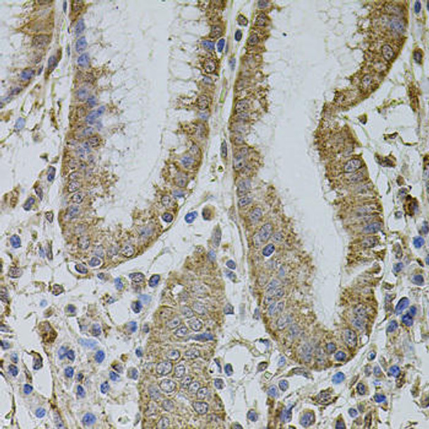 Metabolism Antibodies 3 Anti-MTIF3 Antibody CAB8524