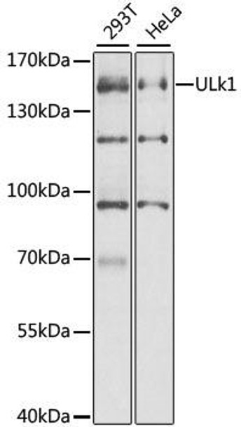 Autophagy Antibodies Anti-ULk1 Antibody CAB8529