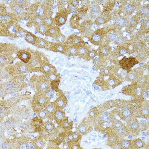 Autophagy Antibodies Anti-ULk1 Antibody CAB8529