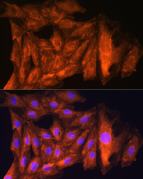 Cell Cycle Antibodies 2 Anti-CKAP5 Antibody CAB8532