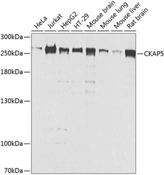 Cell Cycle Antibodies 2 Anti-CKAP5 Antibody CAB8532