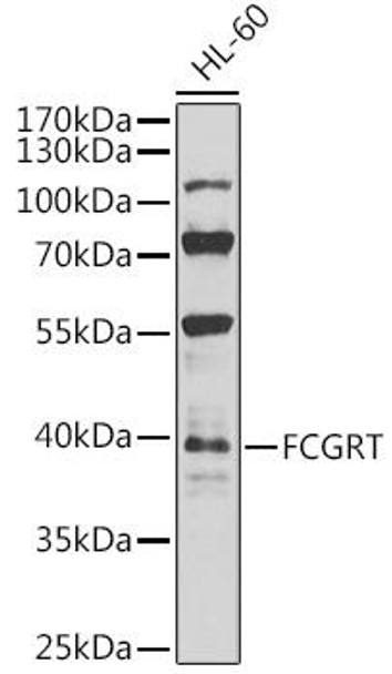 Cell Biology Antibodies 12 Anti-FCGRT Antibody CAB8544