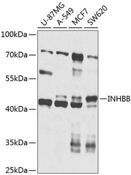 Cell Biology Antibodies 12 Anti-INHBB Antibody CAB8553