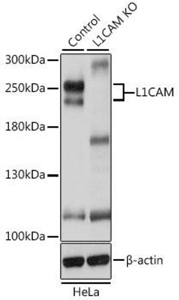 KO Validated Antibodies 1 Anti-L1CAM Antibody CAB8555KO Validated