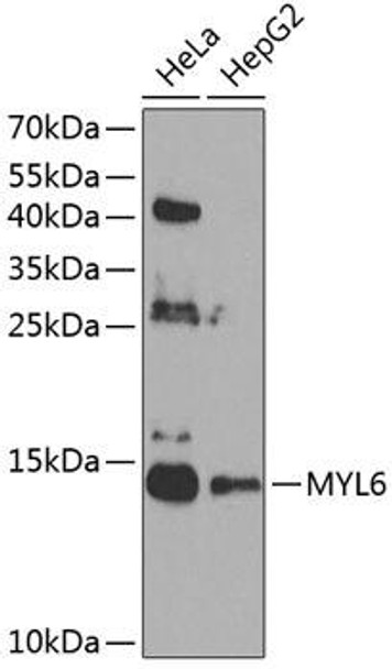 Cell Biology Antibodies 12 Anti-MYL6 Antibody CAB8557