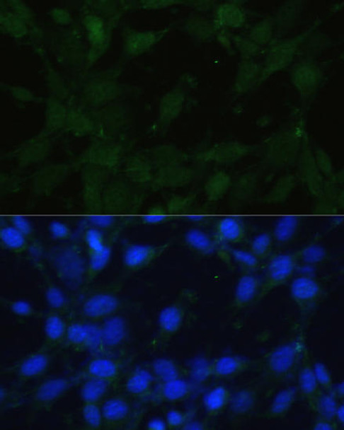 Cell Biology Antibodies 12 Anti-TRPV1 Antibody CAB8564