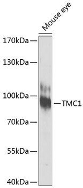 Cell Biology Antibodies 12 Anti-TMC1 Antibody CAB8595