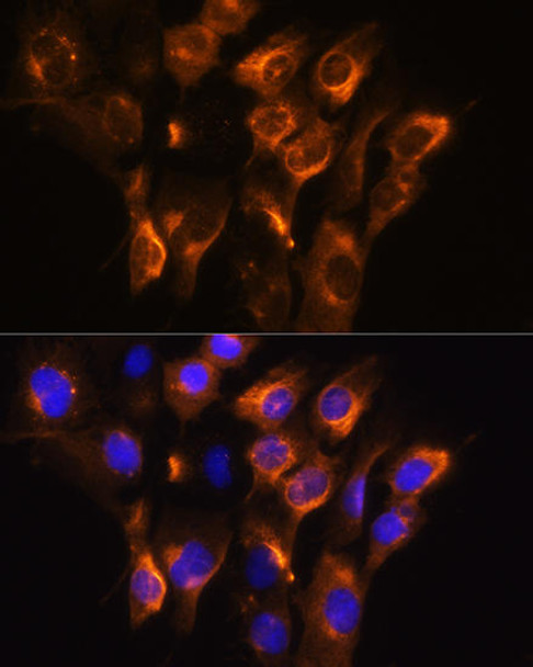 Cell Biology Antibodies 12 Anti-ADRB3 Antibody CAB8607