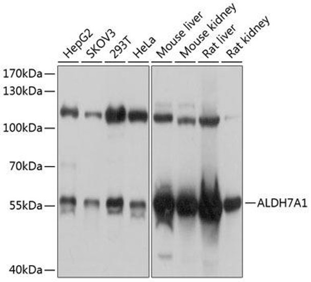 Cell Biology Antibodies 12 Anti-ALDH7A1 Antibody CAB8629