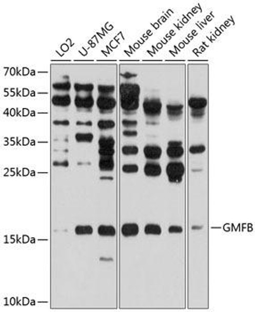 Cell Biology Antibodies 12 Anti-GMFB Antibody CAB8652