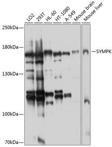 Cell Biology Antibodies 12 Anti-Symplekin Antibody CAB8722