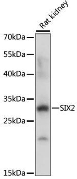 Cell Biology Antibodies 12 Anti-SIX2 Antibody CAB8727