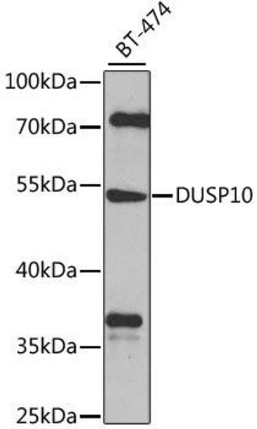 Cell Biology Antibodies 12 Anti-DUSP10 Antibody CAB8748