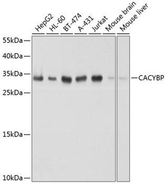 Signal Transduction Antibodies 3 Anti-CACYBP Antibody CAB8757