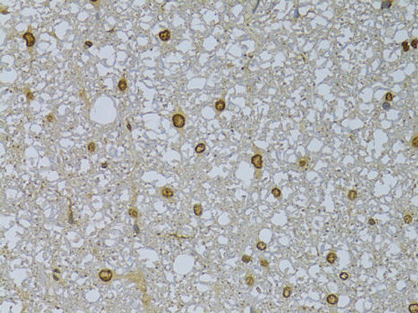 Cell Biology Antibodies 12 Anti-HDGFRP3 Antibody CAB8815