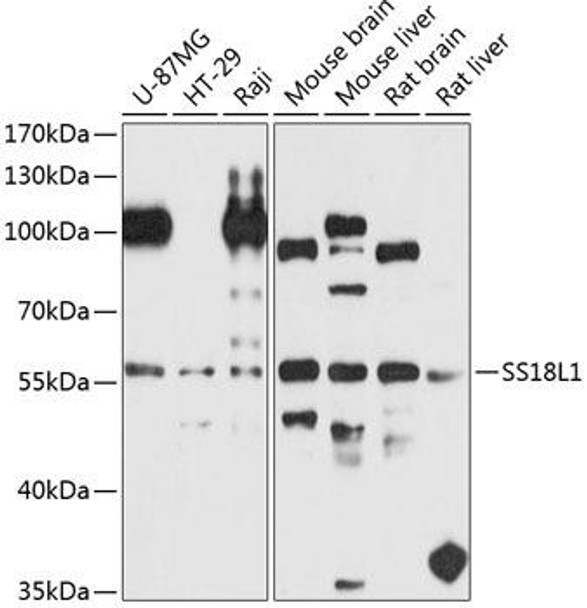 Epigenetics and Nuclear Signaling Antibodies 4 Anti-SS18L1 Antibody CAB8822