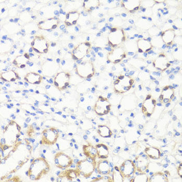 Epigenetics and Nuclear Signaling Antibodies 4 Anti-SS18L1 Antibody CAB8822