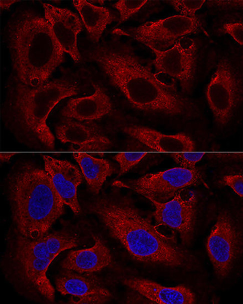 Cell Cycle Antibodies 2 Anti-ARL8B Antibody CAB8869