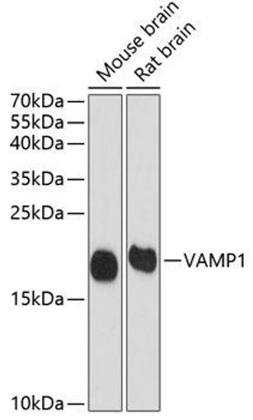 Cell Biology Antibodies 12 Anti-VAMP1 Antibody CAB8877