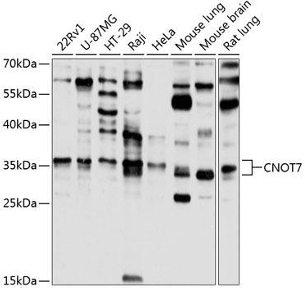 Epigenetics and Nuclear Signaling Antibodies 4 Anti-CNOT7 Antibody CAB8959