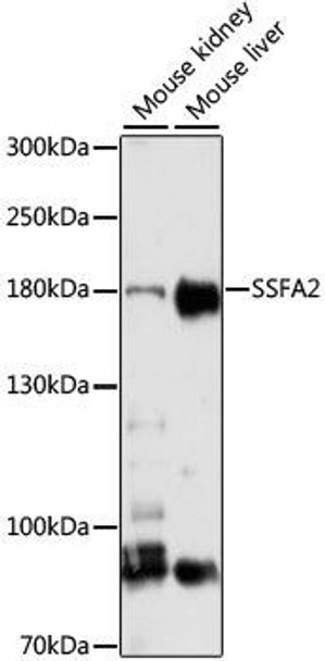 Cell Biology Antibodies 12 Anti-SSFA2 Antibody CAB8967