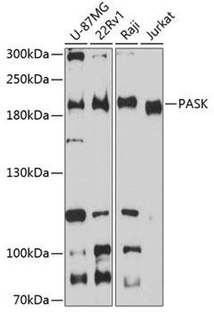 Cell Biology Antibodies 12 Anti-PASK Antibody CAB8995