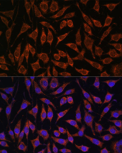 Cell Biology Antibodies 12 Anti-PASK Antibody CAB8995